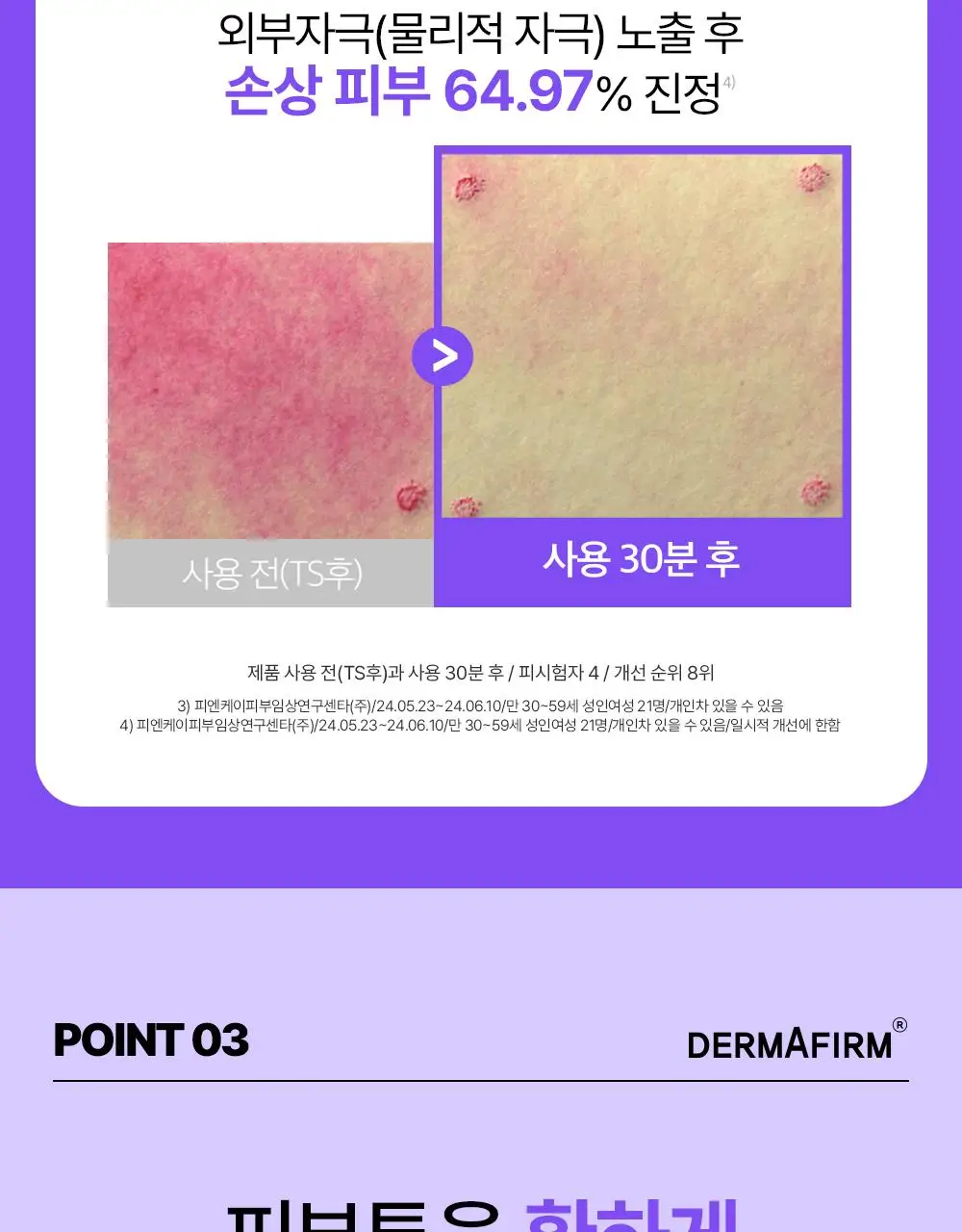 [나띠PICK][흔적케어크림] 더마펌 수딩 리페어 토닝 크림 R4 50ml 기획 (+30ml) 상세페이지 24